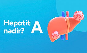 Hepatit A